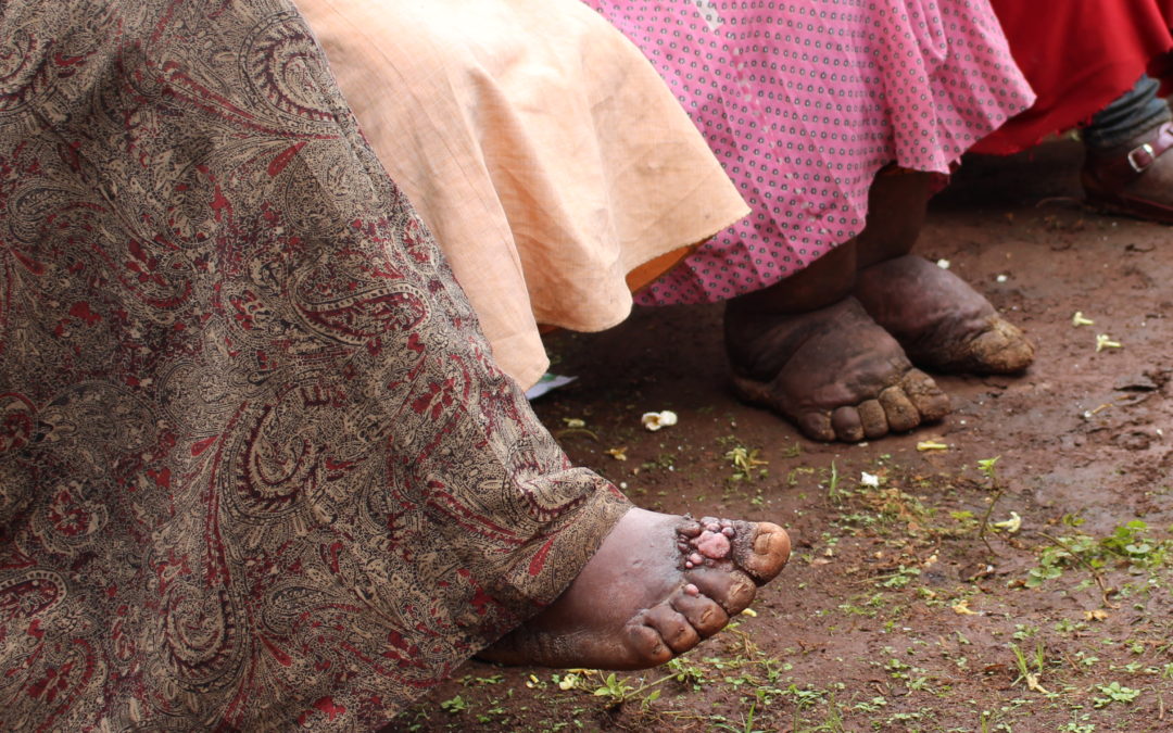 Mossy Foot Education